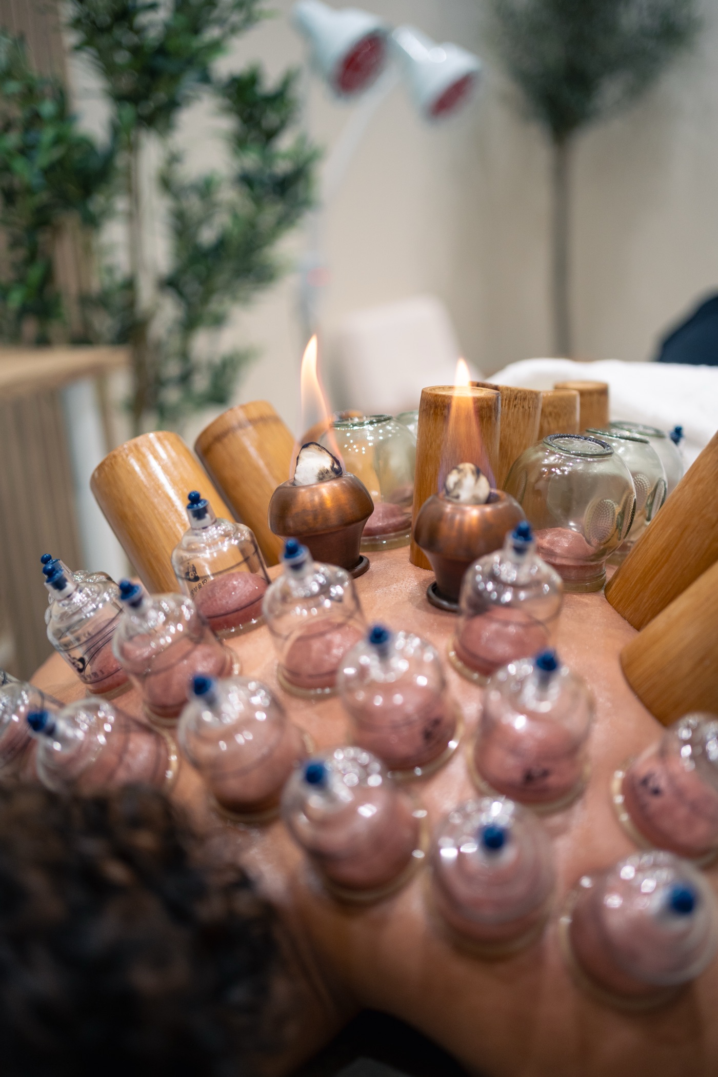 Hijama dos — DAR HIJAMA Brussel